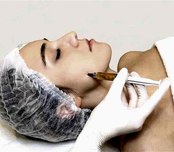 Плазмотерапия prp-терапия CORTEXIL