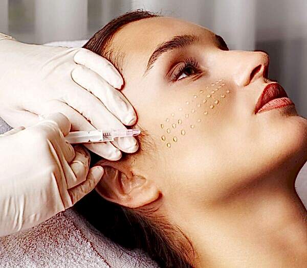 Мезотерапия