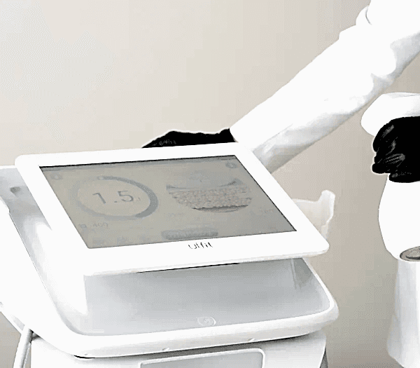 Ультразвуковой аппарат ULFIT