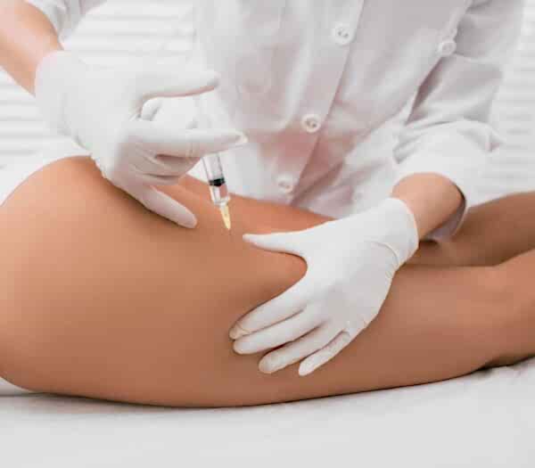 Офисная липоскульптура