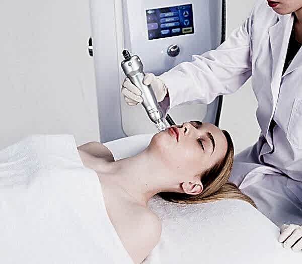 Микроигольчатый RF лифтинг